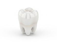 Цельноциркониевая коронка